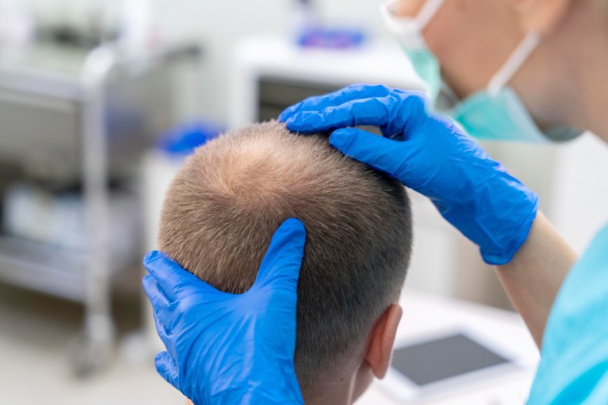Do Hair Transplant Prices in the Philippines Include Aftercare?
