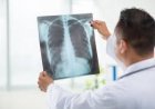 X-Ray Lab in Bangalore: What to Look For
