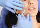 A Practical Guide to Dermal Fillers: Understanding Facial Volume and Balance