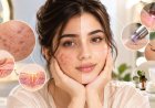 Dark Spot Cream: A Complete Guide to Brighter, More Even-Looking Skin