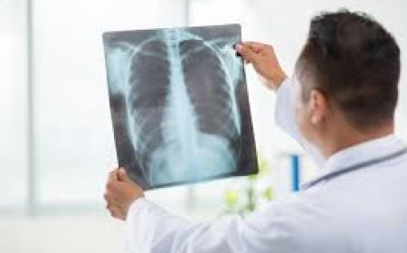 X-Ray Lab in Bangalore: What to Look For