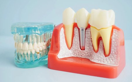 What If the Infection Comes Back After a Root Canal?