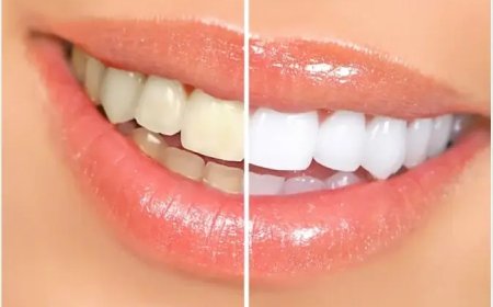 Dentist Dubai | Dental Treatments, Procedures and Care Guide