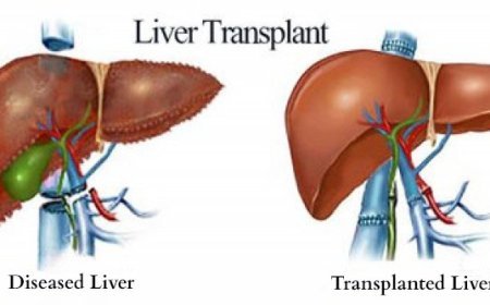 Best Liver Transplant Doctor in Noida: Care and Expertise