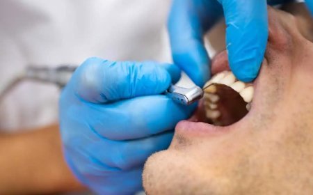 Stop Letting Dental Insecurities Hold You Back: Life-Changing Cosmetic Dentistry Options in Mississauga