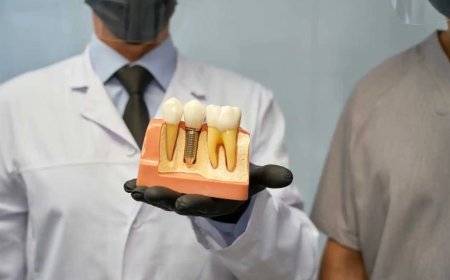 Afraid of Surprising Dental Bills? Here is What Dental Implants Actually Cost in Mississauga