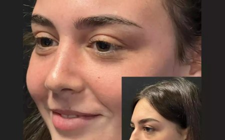 How Does the Best Rhinoplasty Surgeon in Dubai Ensure Safety?