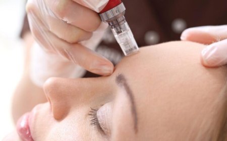 Mesotherapy Treatment in London: Understanding the Role of Personalised Skin Planning