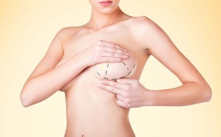 Understanding Patient Preferences for Breast Augmentation in Dubai
