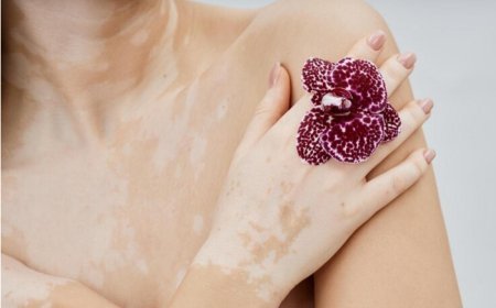 Value of Regular Follow-up: Homoeopathy and Vitiligo