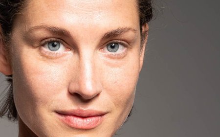 Upper Blepharoplasty in London: How Can Eyelid Surgery Support a More Refreshed Appearance?