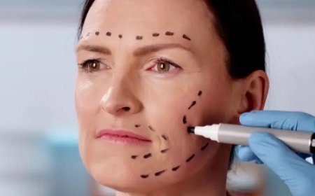 Can a Facelift Help You Look Naturally Refreshed?