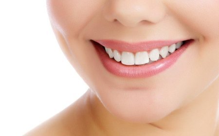 Implants Specialist Near Bixby Knolls: Questions to Ask Before Treatment