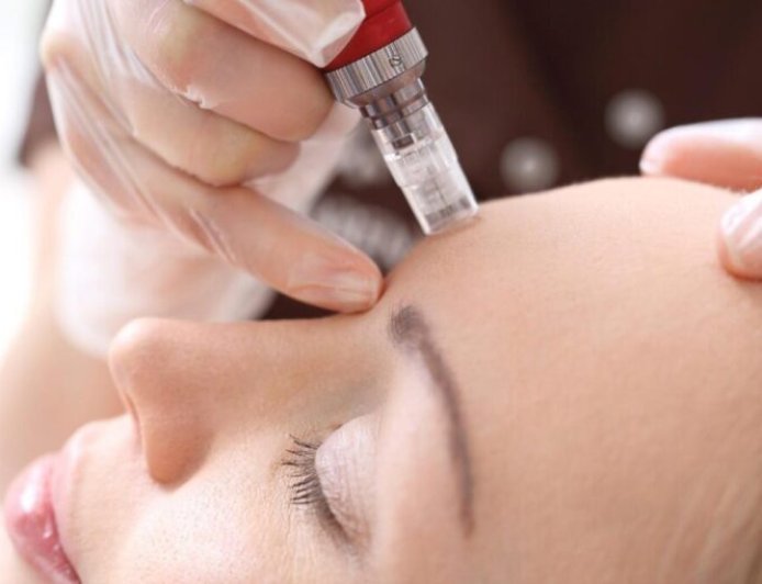 Mesotherapy Treatment in London: Understanding the Role of Personalised Skin Planning
