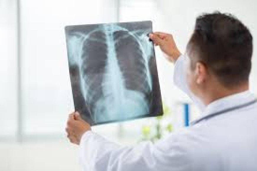 X-Ray Lab in Bangalore: What to Look For