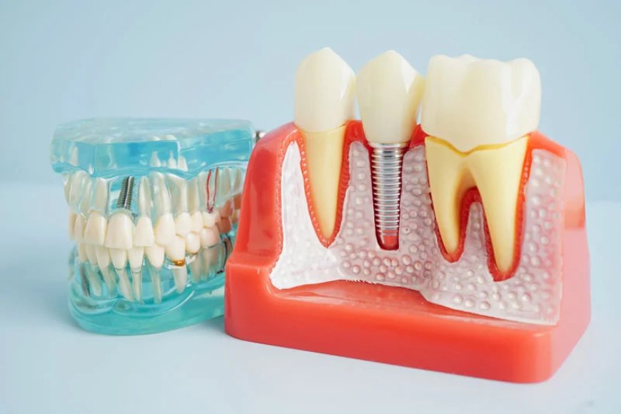 What If the Infection Comes Back After a Root Canal?