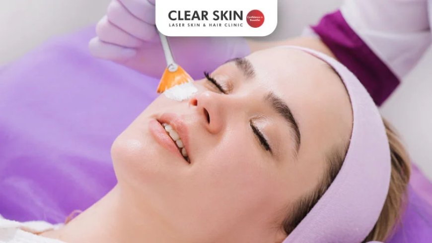 Can Permanent Skin Whitening Treatment Improve Uneven Skin Tone?