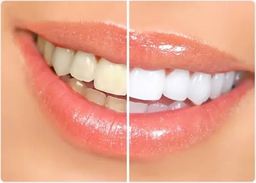 Dentist Dubai | Dental Treatments, Procedures and Care Guide