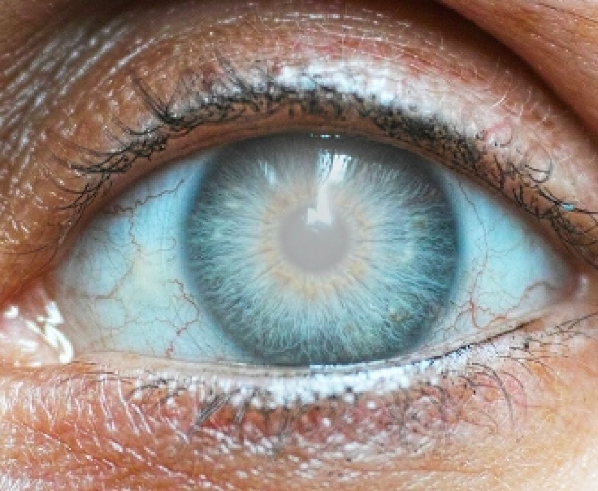 Eye Test at Home in Delhi: Common Tests and What They Check