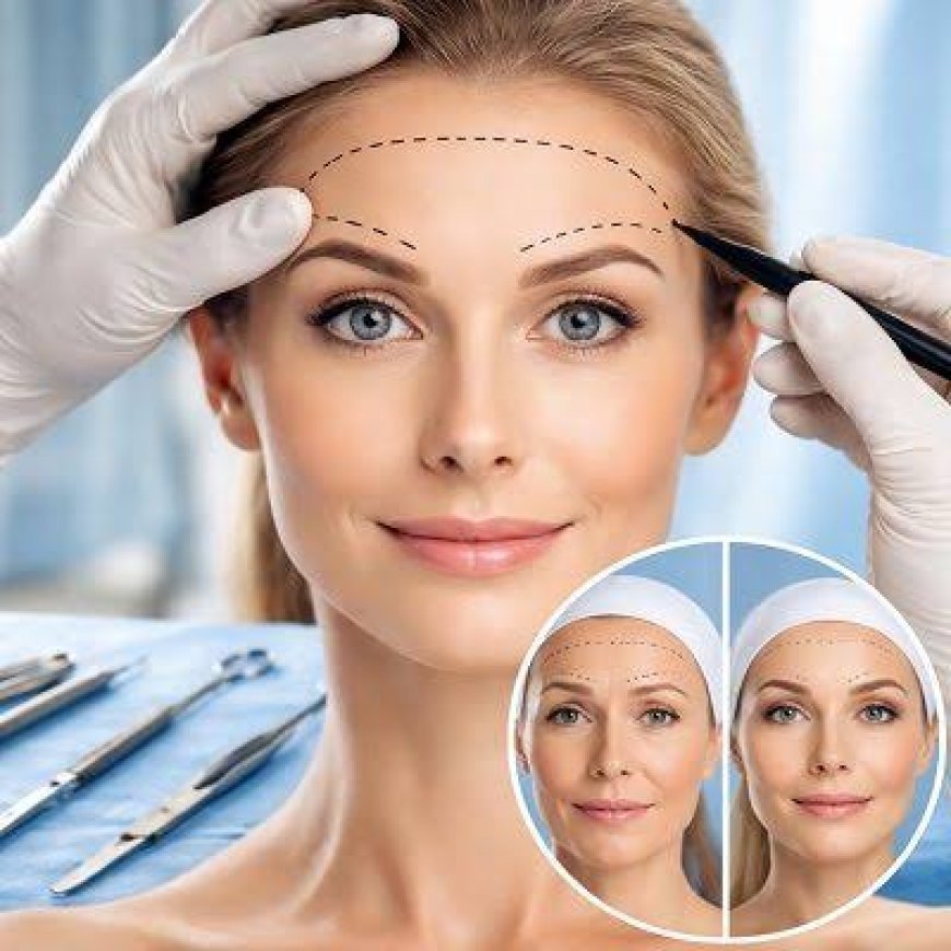 Can a Forehead Lift Help Reduce the Appearance of Deep Forehead Lines?