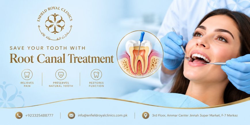 What Factors Affect Root Canal Treatment Success?