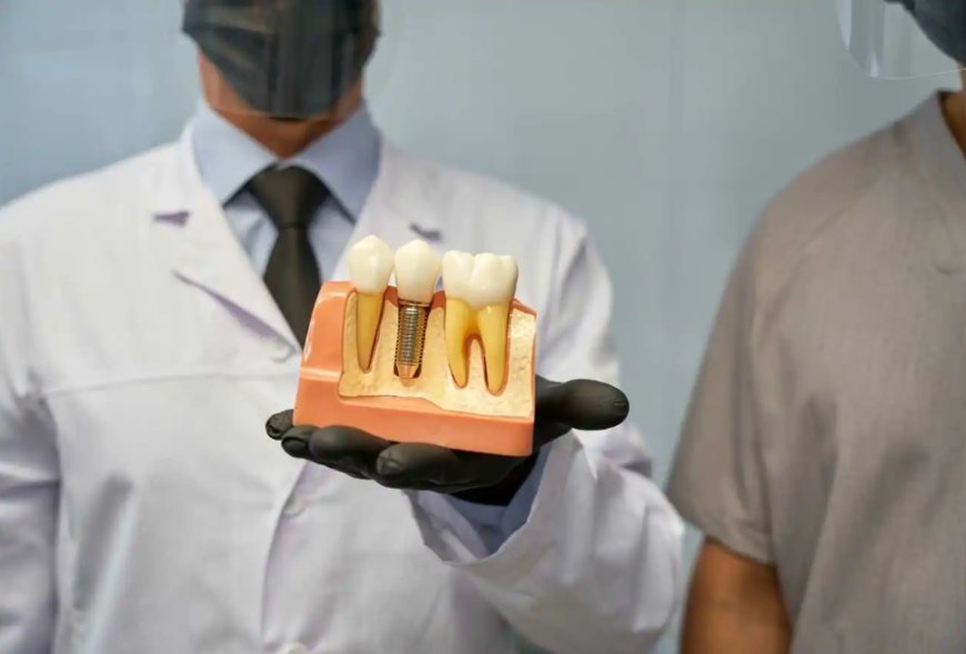 Afraid of Surprising Dental Bills? Here is What Dental Implants Actually Cost in Mississauga