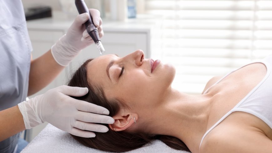 Microneedling Surrey BC: Benefits, Results & Skin Care Guide