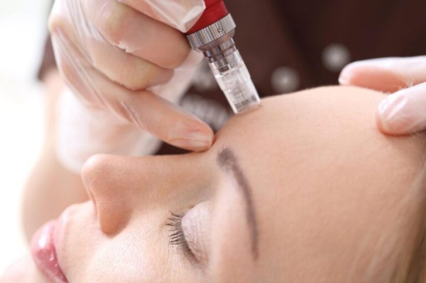 Mesotherapy Treatment in London: Understanding the Role of Personalised Skin Planning