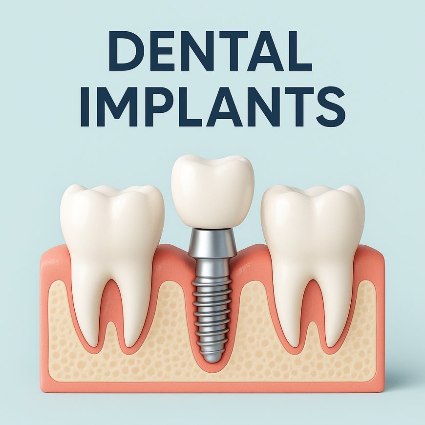 Dental Implant in Kathmandu: Restore Your Smile at Glow Skin & Dental Clinic
