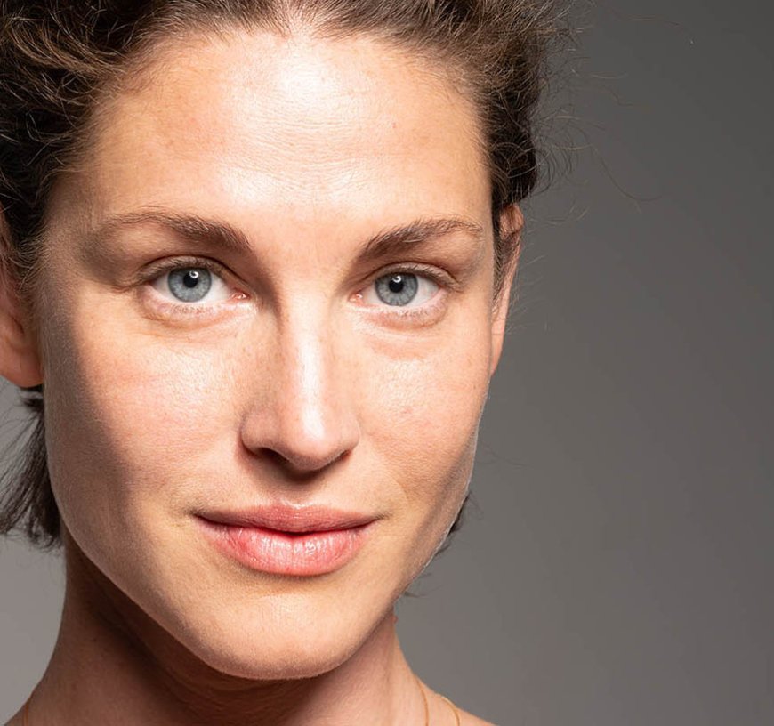 Upper Blepharoplasty in London: How Can Eyelid Surgery Support a More Refreshed Appearance?