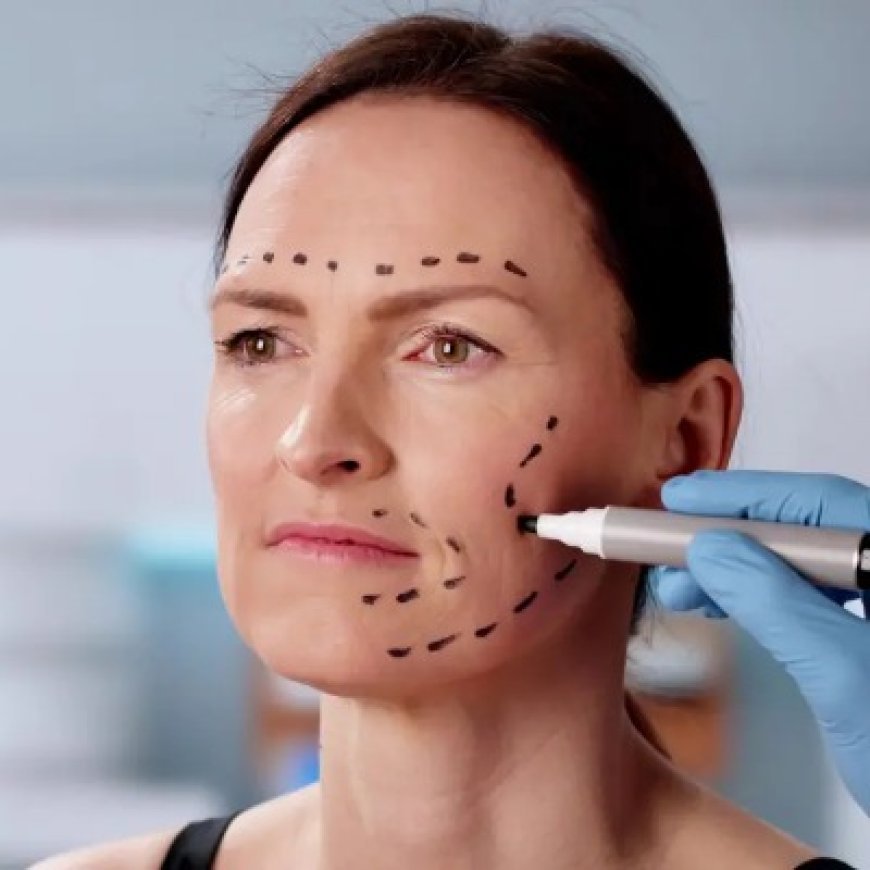 Can a Facelift Help You Look Naturally Refreshed?