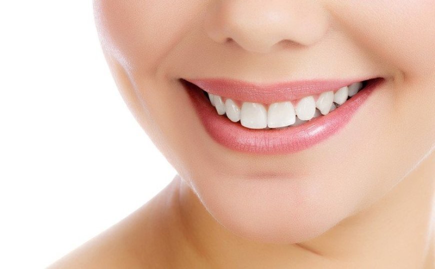 Implants Specialist Near Bixby Knolls: Questions to Ask Before Treatment